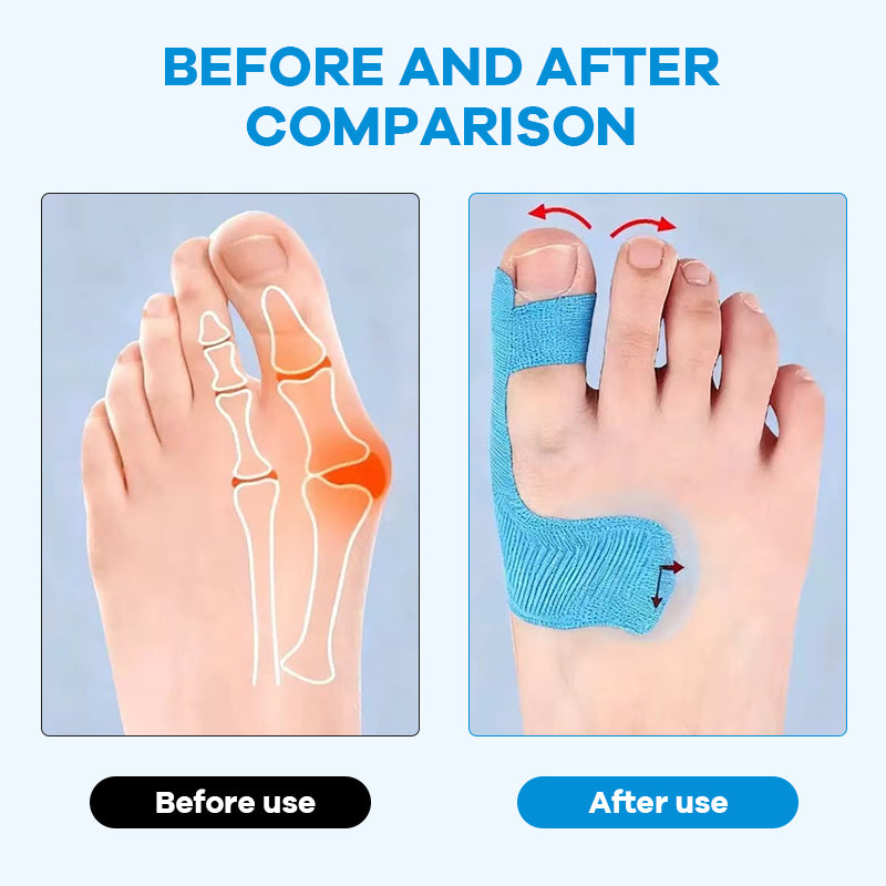 ✨Bär vilka skor du vill – utan smärta från hallux valgus! 👠💃